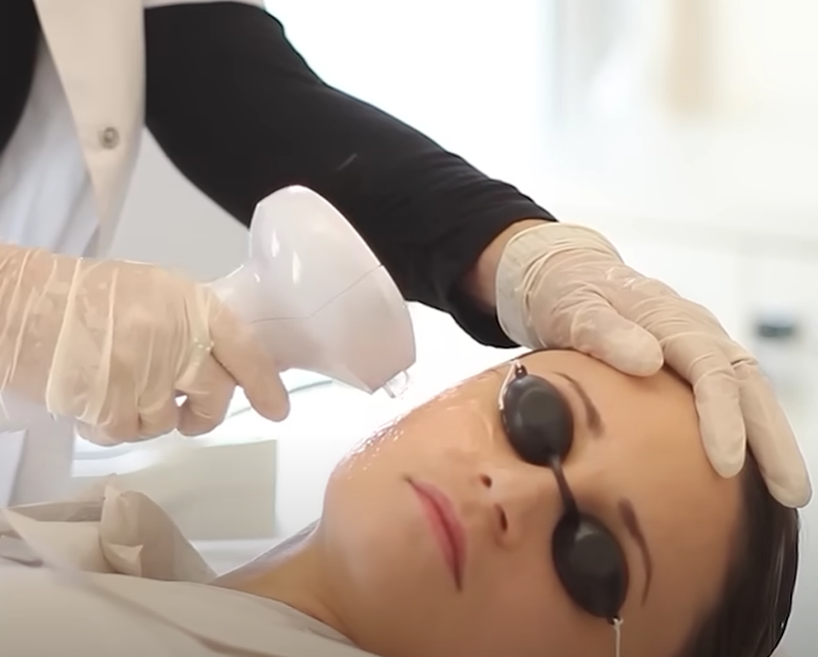 Maximize Your Results: Essential Aftercare for Tixel, Morpheus8, and IPL Treatments
