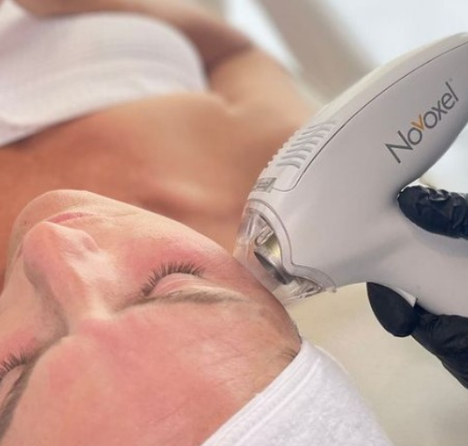 Maximize Your Results: Essential Aftercare for Tixel, Morpheus8, and IPL Treatments