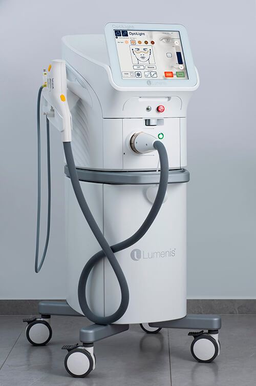 LUMENIS OPTILIGHT IPL DRY EYE TREATMENT. EXPLAINED